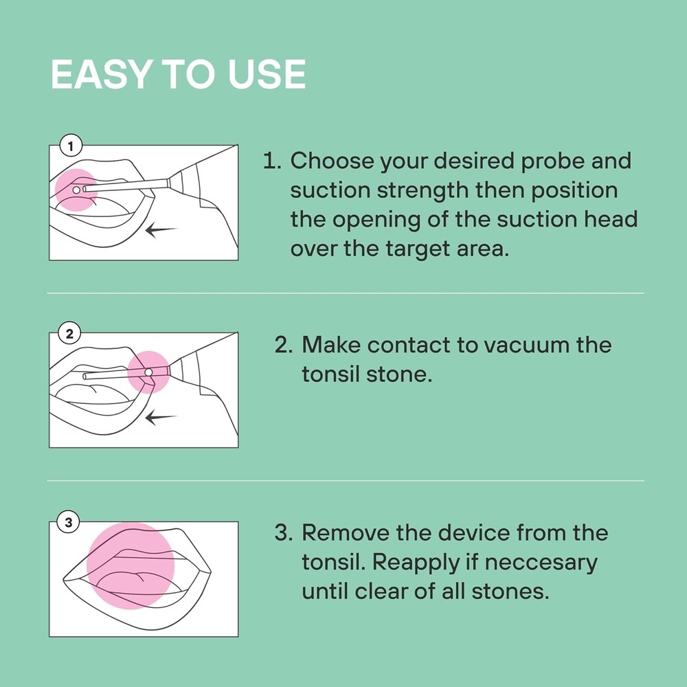 Instant Suction Tonsil Stone Remover - Compact Electric Device with LED Light