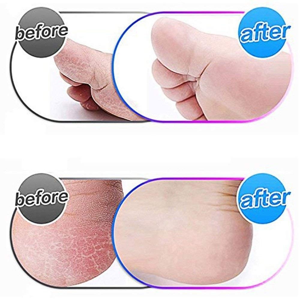 8 Pack Extra Coarse Replacement Rollers for Amope Pedi Refills Electronic Perfec
