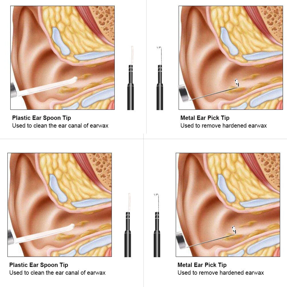 HD Ear Endoscope Otoscope LED Camera Tool Cleaning Wax Pick Cleaner Removal Kit