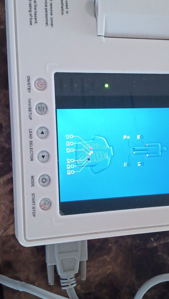 Digital Electrocardiograph ECG Machine with Printer & Lithium Battery