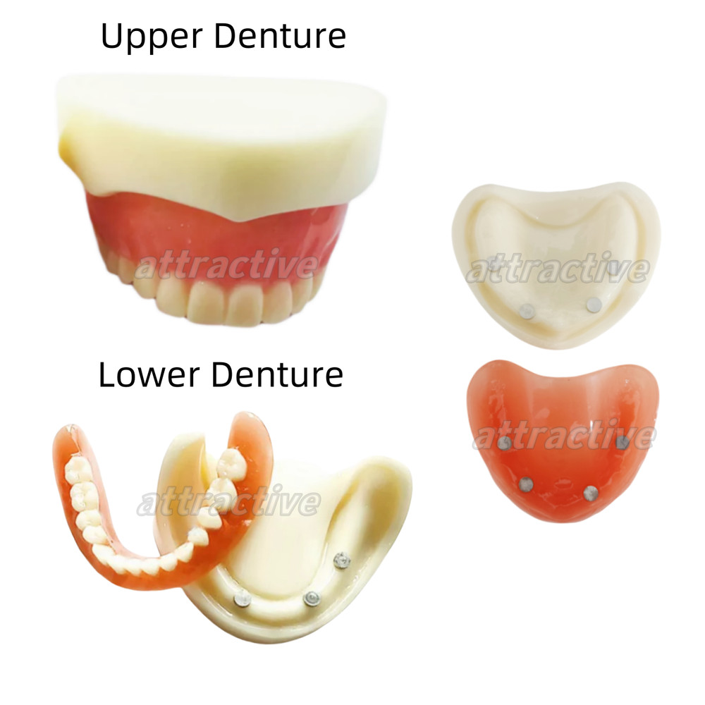Dental Full Denture Study Model Magnetic Attachment Mandibular Upper/Lower