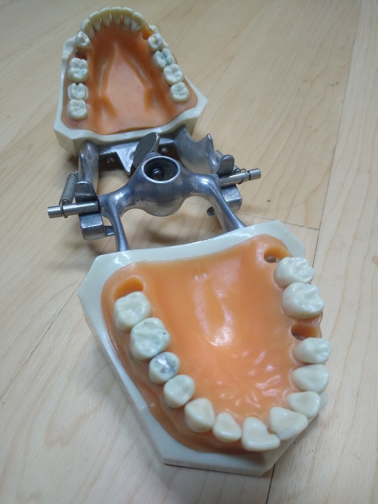 Columbia Dental Typodont Teeth Model R861 with Removable Teeth (missing 5 teeth)