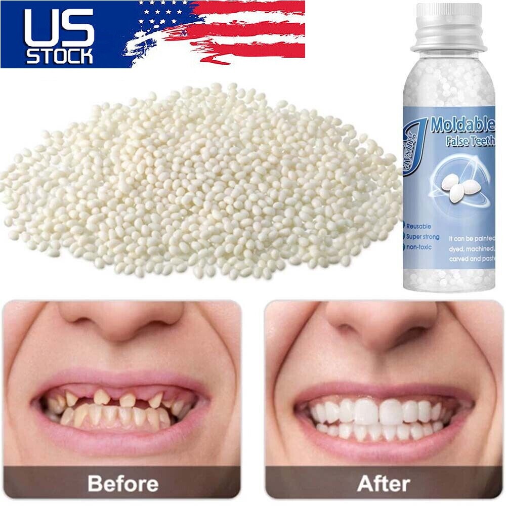 Resin False Teeth Solid Glue Temporary Tooth Repair Set Teeth And Gap Adhesive