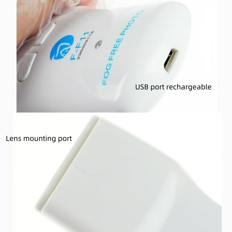 Dental Occlusal Mirror Device Fog Free with 4 Intraoral Reflective Mirrors Kit