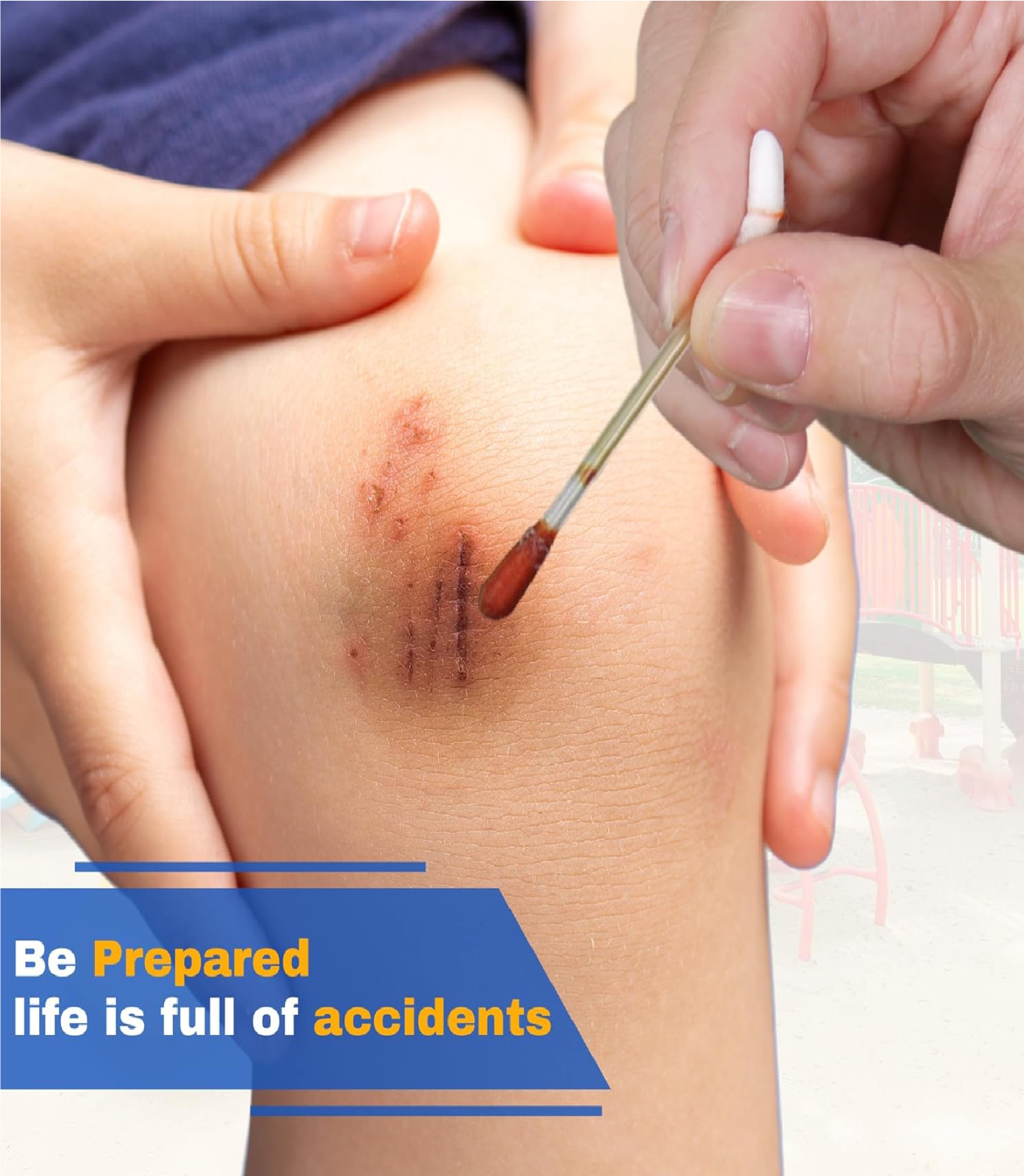 FrontLine Povidone Iodine Swabs, Antiseptic Swabsticks, Iodine SolutionBox of 50