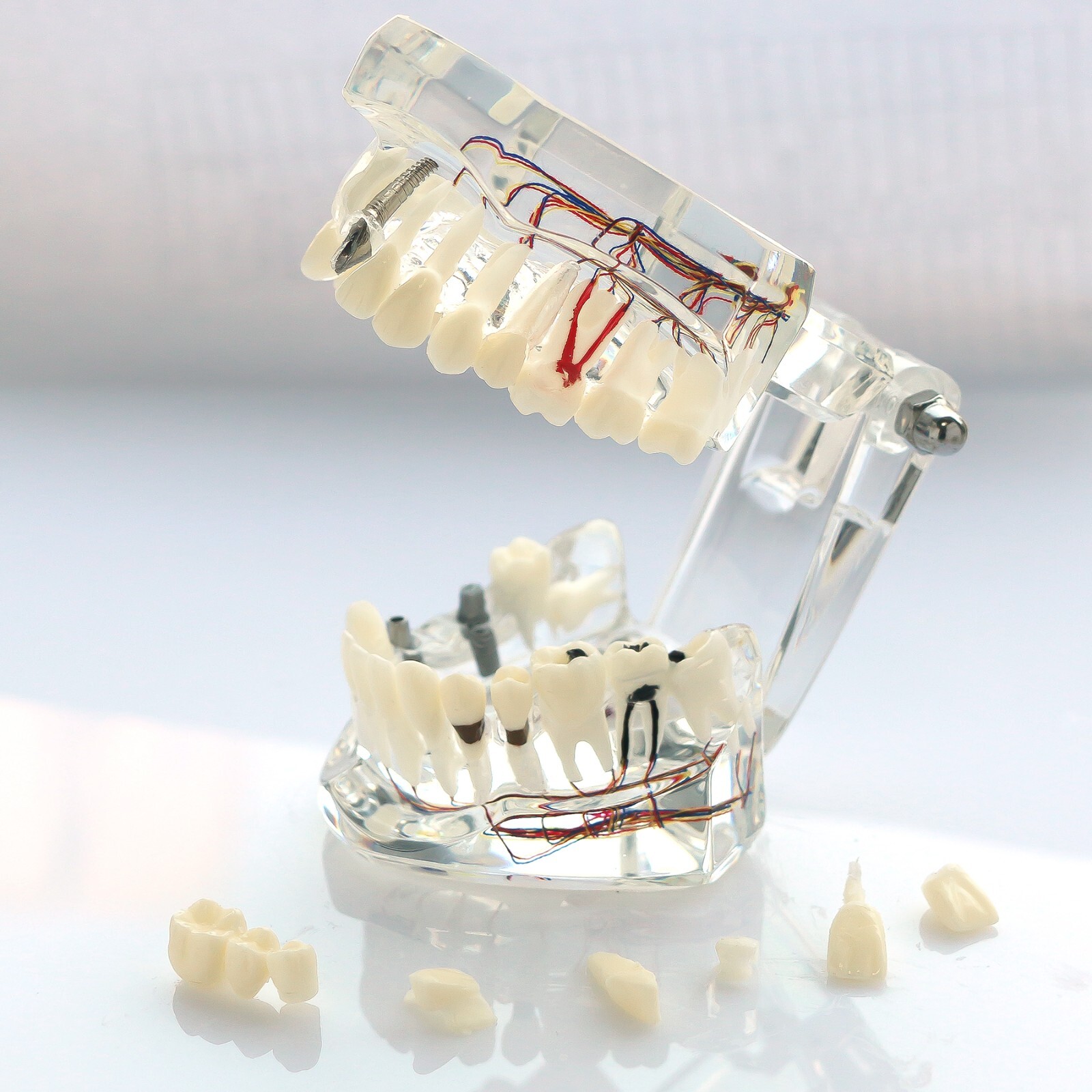 Dental Oral Typodont Model Implant Pathological Teaching Standard Size (Clear)