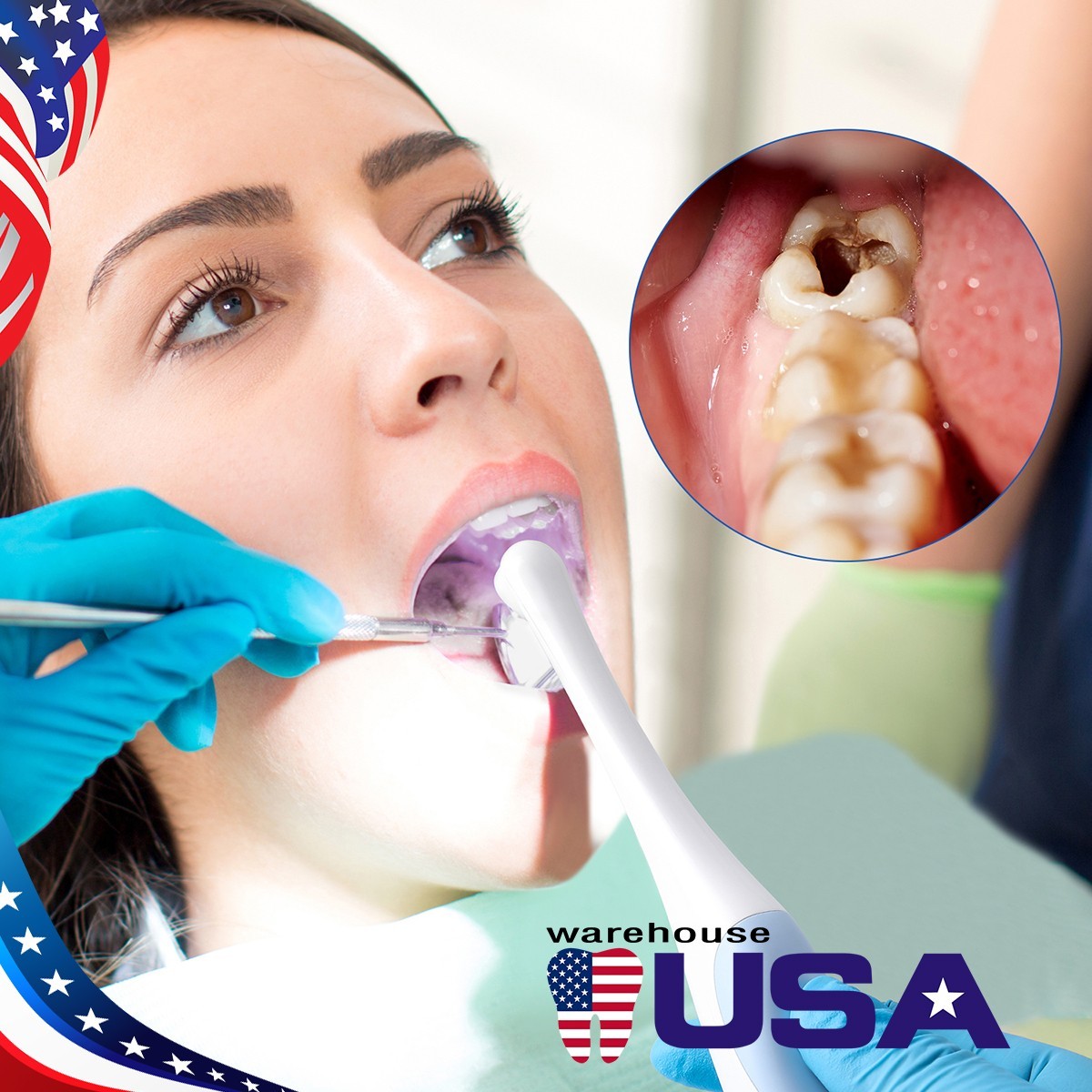 USB-C Intraoral Camera 1920*1440P HD 8 LED Auto Focus Apple Android Dental