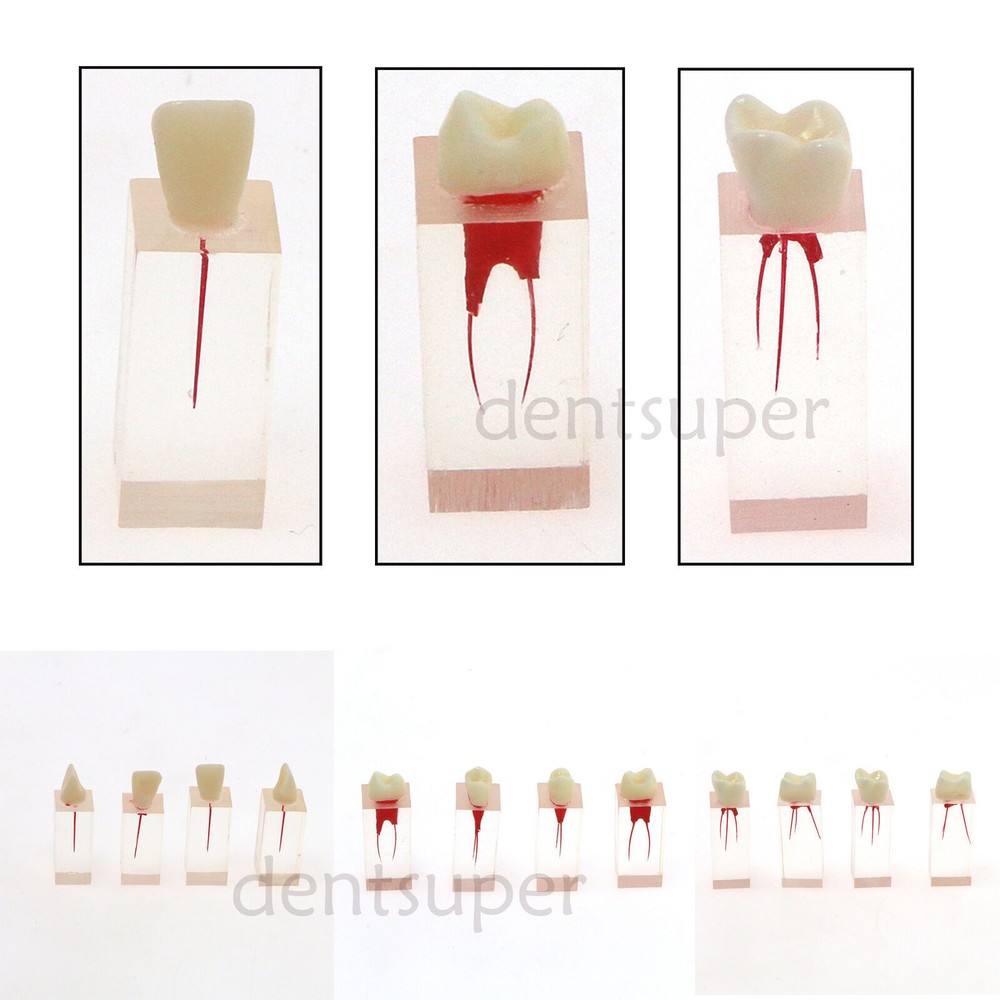 Dental Endo Root Canal Teeth Model Study Practice Block RCT Pulp Cavity