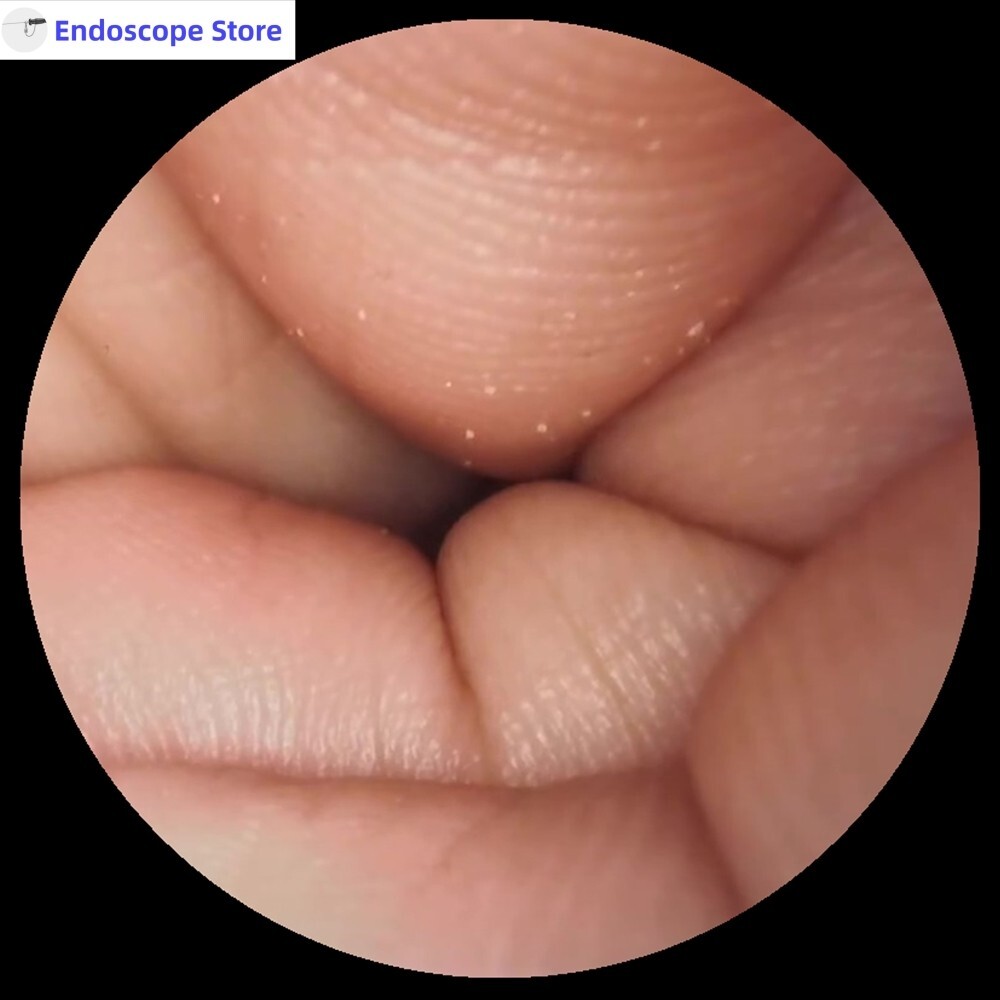 Medical LED 100W Endoscope Microscope Cold Light Source Match WOLF Customized