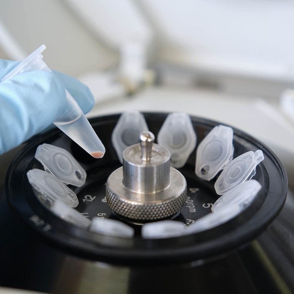500 Sterilized 1.5ml Microcentrifuge Tubes - Precise Scale for Accurate Sampling