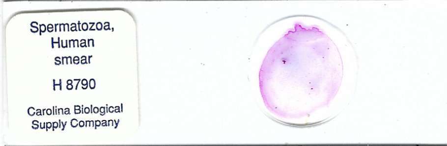 Human Spermatozoa Smear Microscope Slide