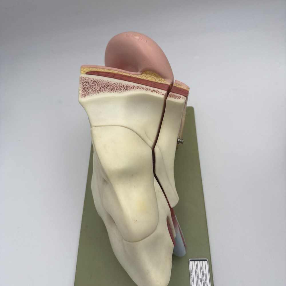 Somso DS5 Ear Anatomical Model - Hearing Inner Ear