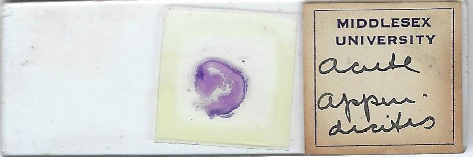 Human Acute Appendicitis Pathology Microscope Slide