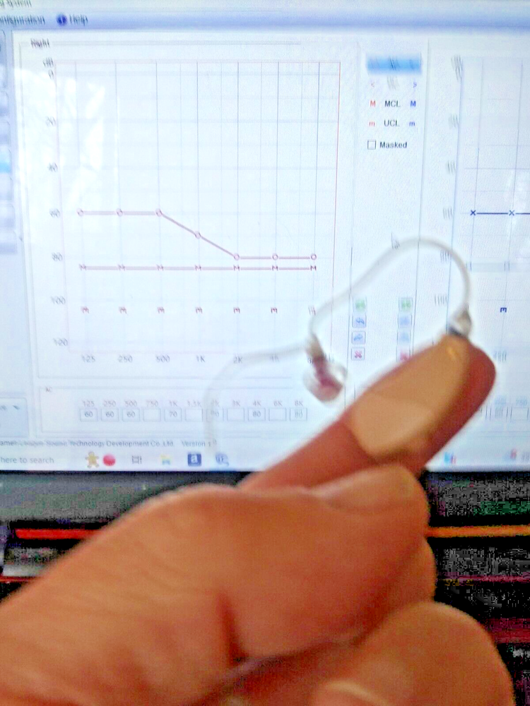 PROGRAMMABLE mini BTE HEARING AID RIGHT .4 PROGRAMS fit severe profound loss US