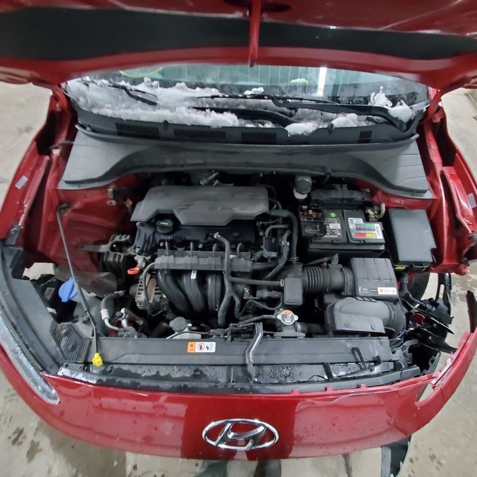 Camera/Projector Camera Windshield Mounted Fits 22-23 KONA 1157591