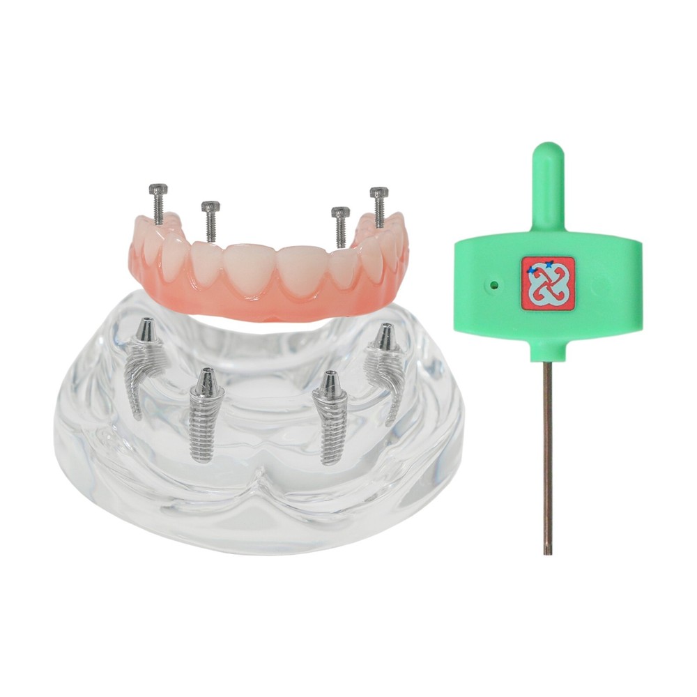 Implant Practice Demo Multiple Types Dental Teaching Teeth Model Typodont Ortho