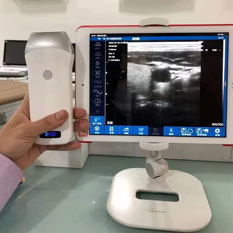 IOS Android Windows 80 Elements Linear Array Wireless Ultrasound Scanning Probe
