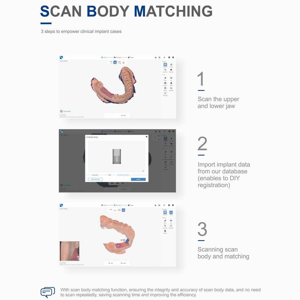 Intraoral 3D Impression Scanner
