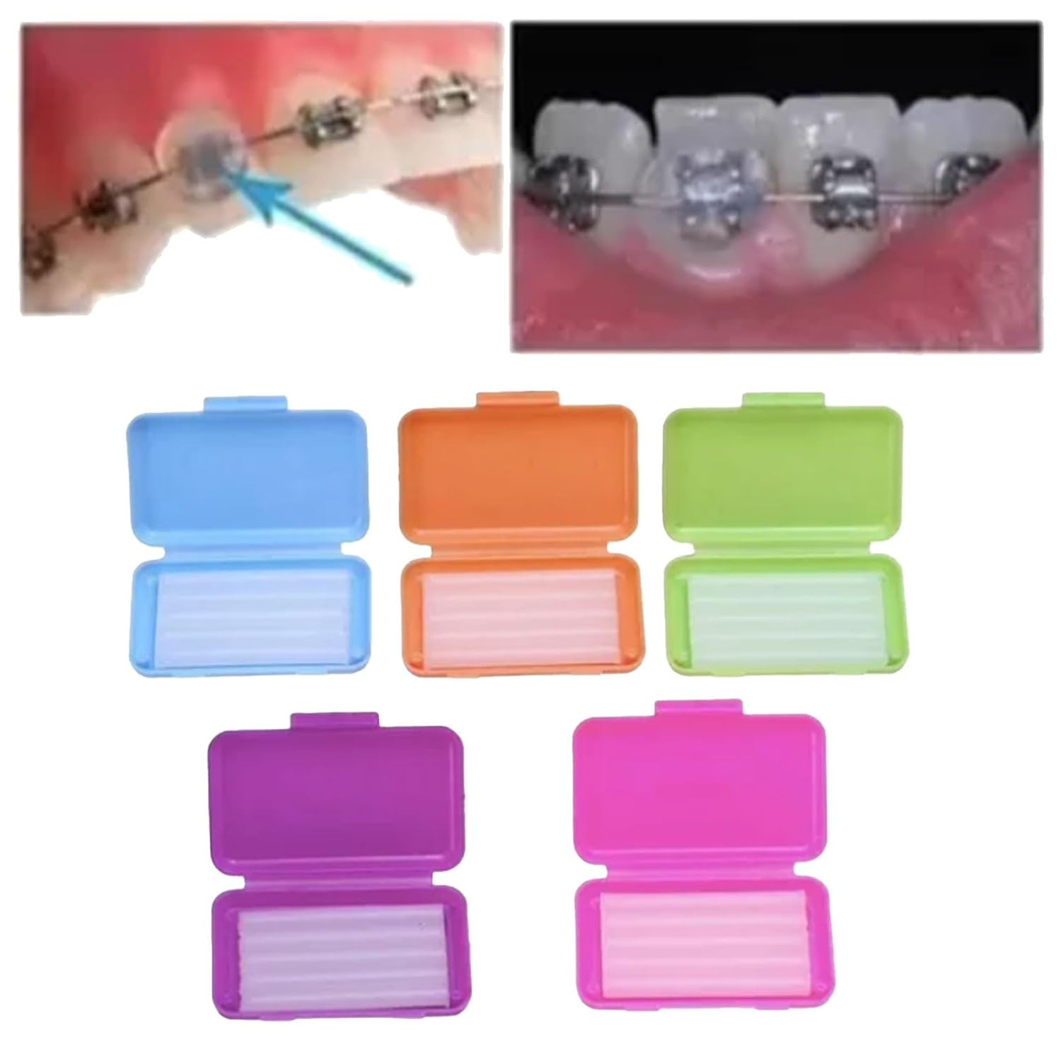 10 Scents Dental Orthodontics Ortho Wax For Braces Gum Irritation 100 Packs