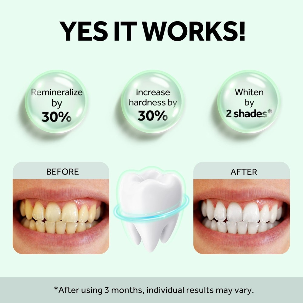 MySmile Nano Hydroxyapatite Toothpaste Fluoride Free Sensitive Relief Mint 4.2oz