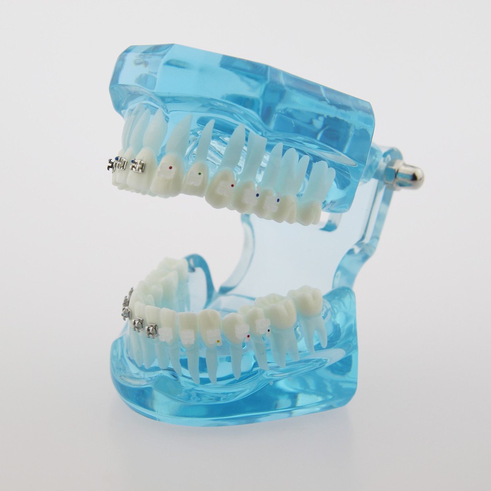 Dental Teach Study Typodont Teeth Model Half Metal Bracket Half Ceramic Bracket