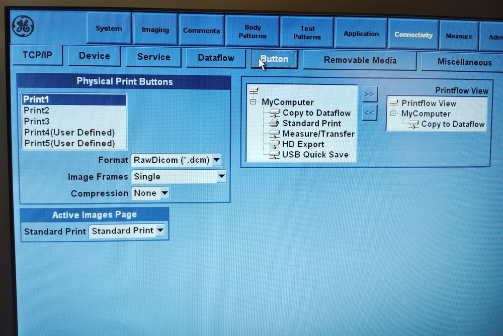 GE LOGIQ E Ultrasound System