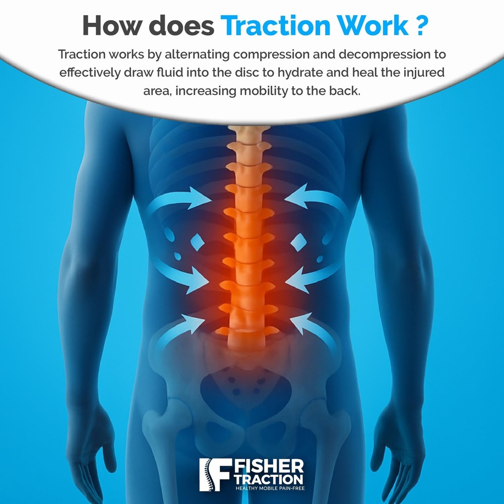 Lower Back Decompression Device – Lumbar Traction for Spinal Decompression – ...