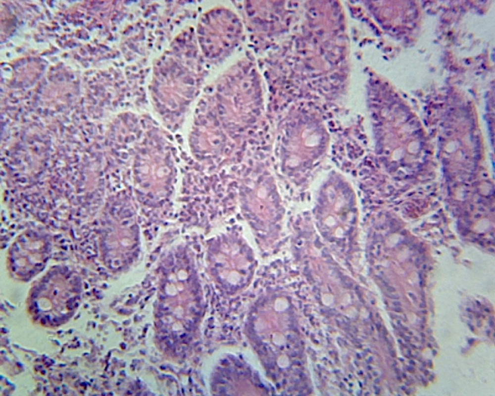 Frog Stomach; Section; H&E Stain