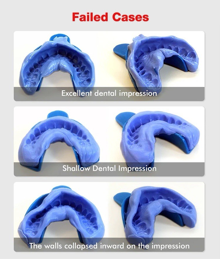 Glory smile teeth dental impression mold kit