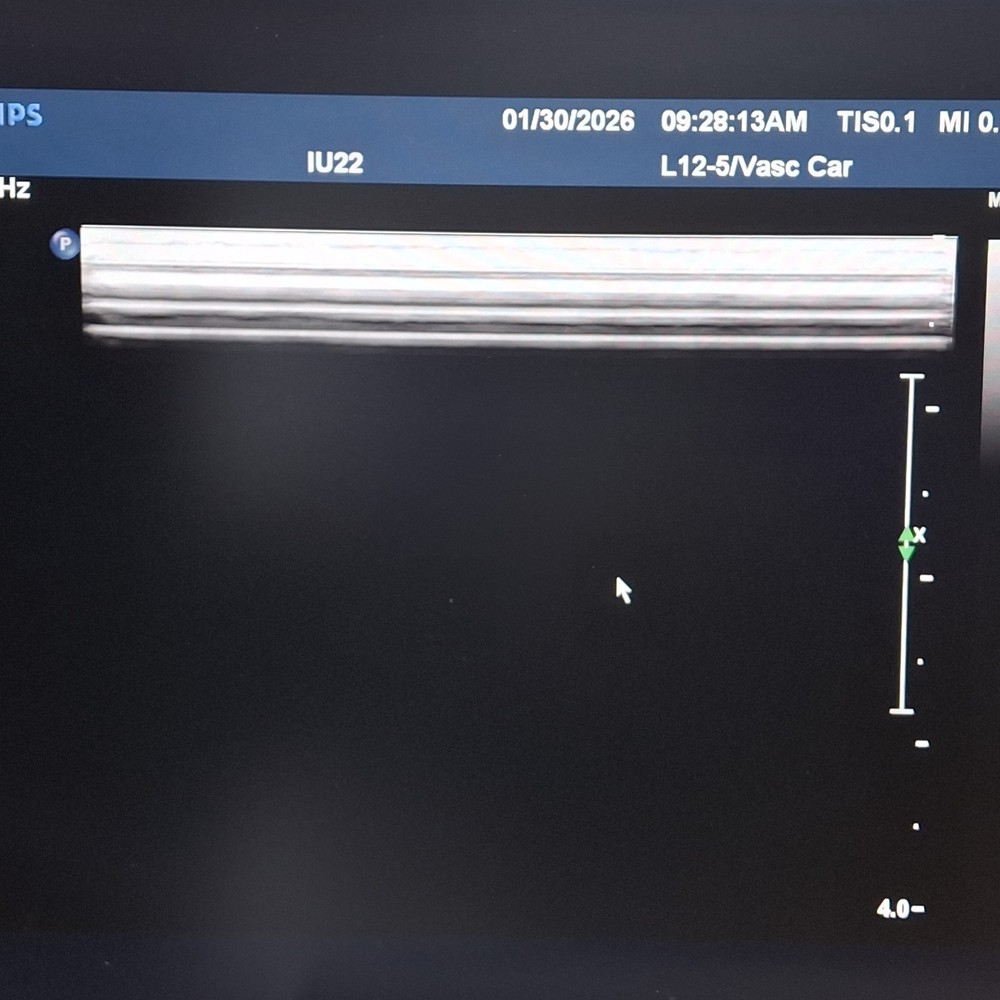 Philips L12-5 IU22/IE33 Linear Transducer