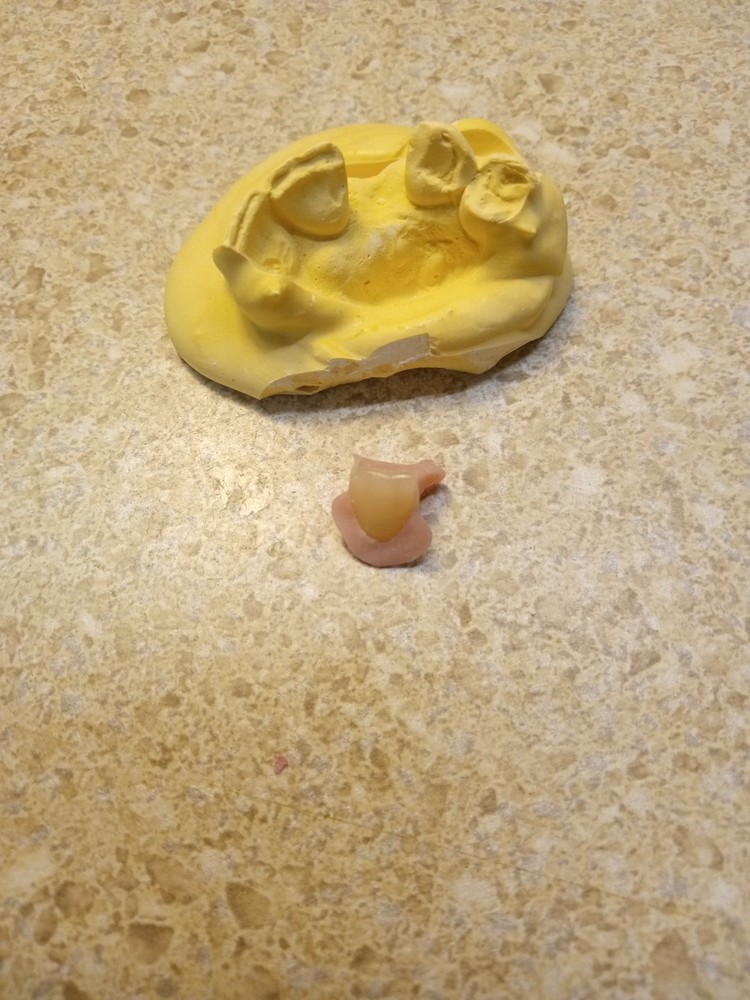 DIY Nesbit Tooth Partial, Give Us Your #'s *See Full DESCRIPTION before buying.*