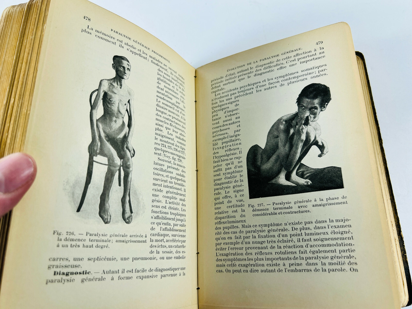 RARE 1904 Manual of Psychiatry ODDITY Medical Book AMAZING weygandt