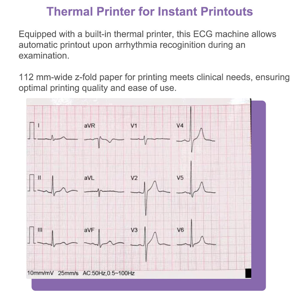 Biocare iE6 12 lead 6 channel ECG Machine Touchscreen with interpretation FDA US