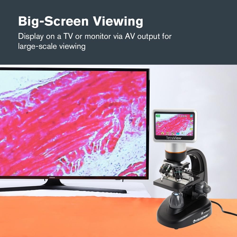 Celestron – TetraView LCD Digital Microscope – Biological Microscope with 5MP