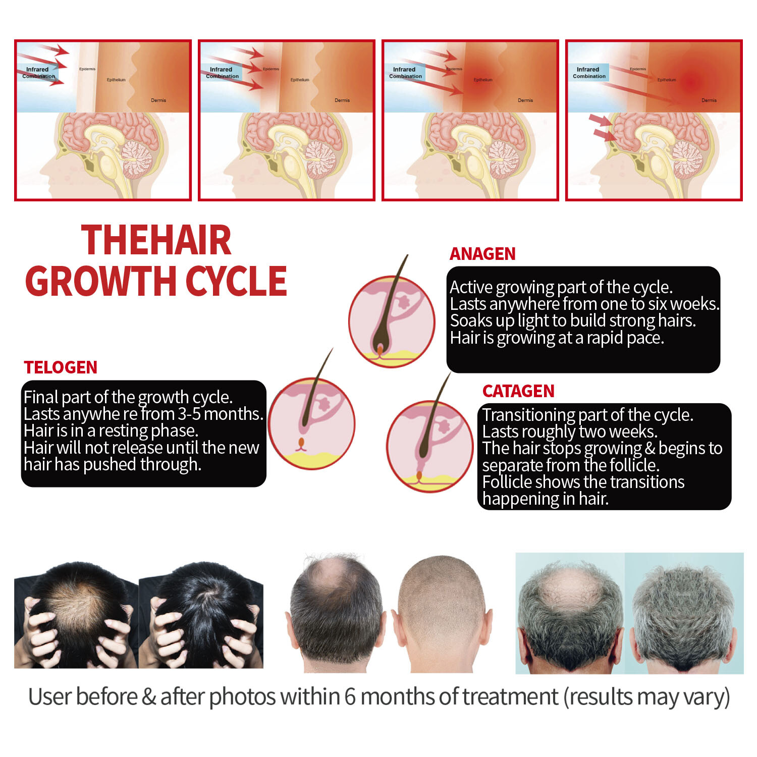 224 LEDs 880nm Infrared Red Light Hair Cap for Hair Loss Regrowth Helmet Device