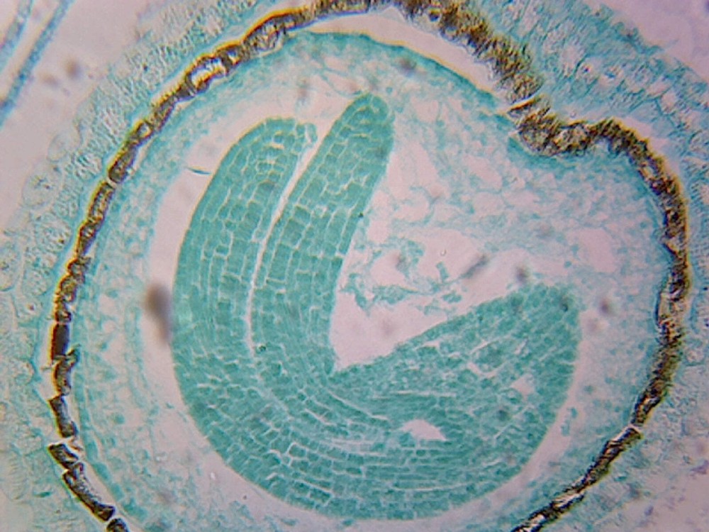 Capsella Embryo, Later Cotyledon Stage; Longitudinal Section