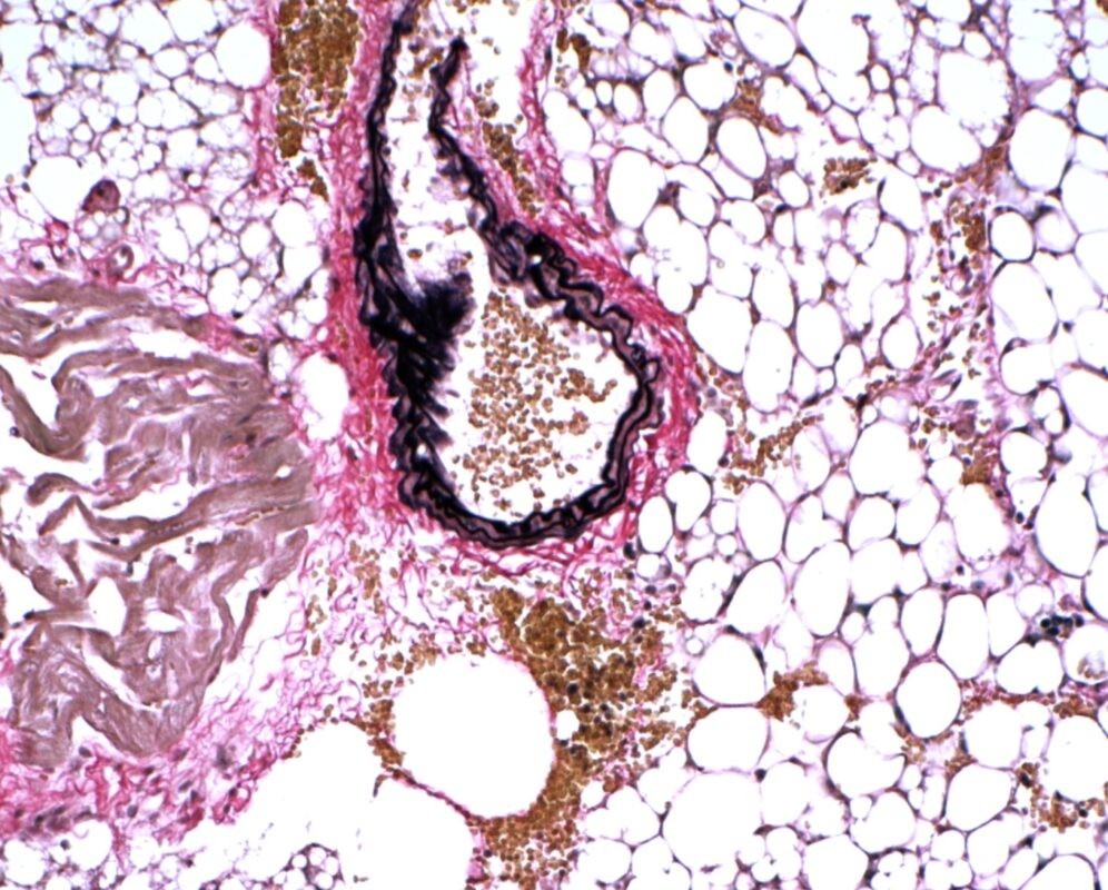 VitroView™ Verhoeff Van Gieson Elastin Stain Kit (Cat# VB-3019)