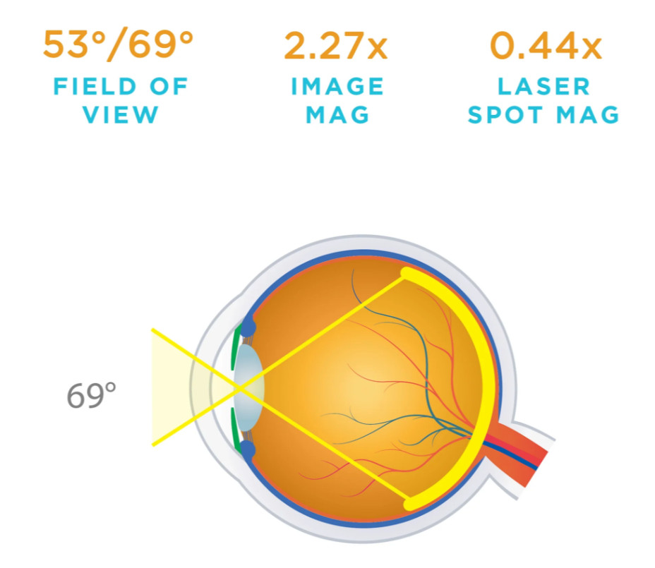 Volk 28D ACS BIO Double Aspheric Lens w/ Case - Excellent! Autoclave Compatible