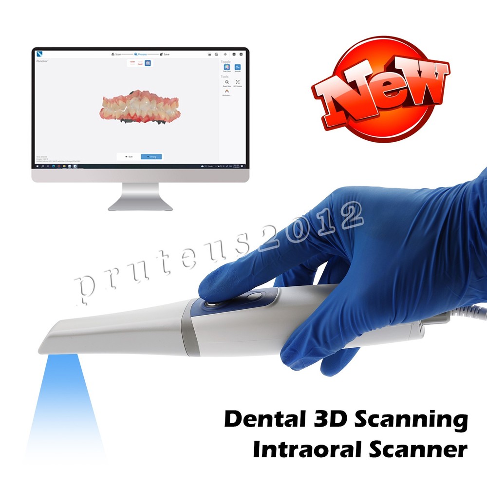 IntraOral Scanner - Digital Dental Solutions