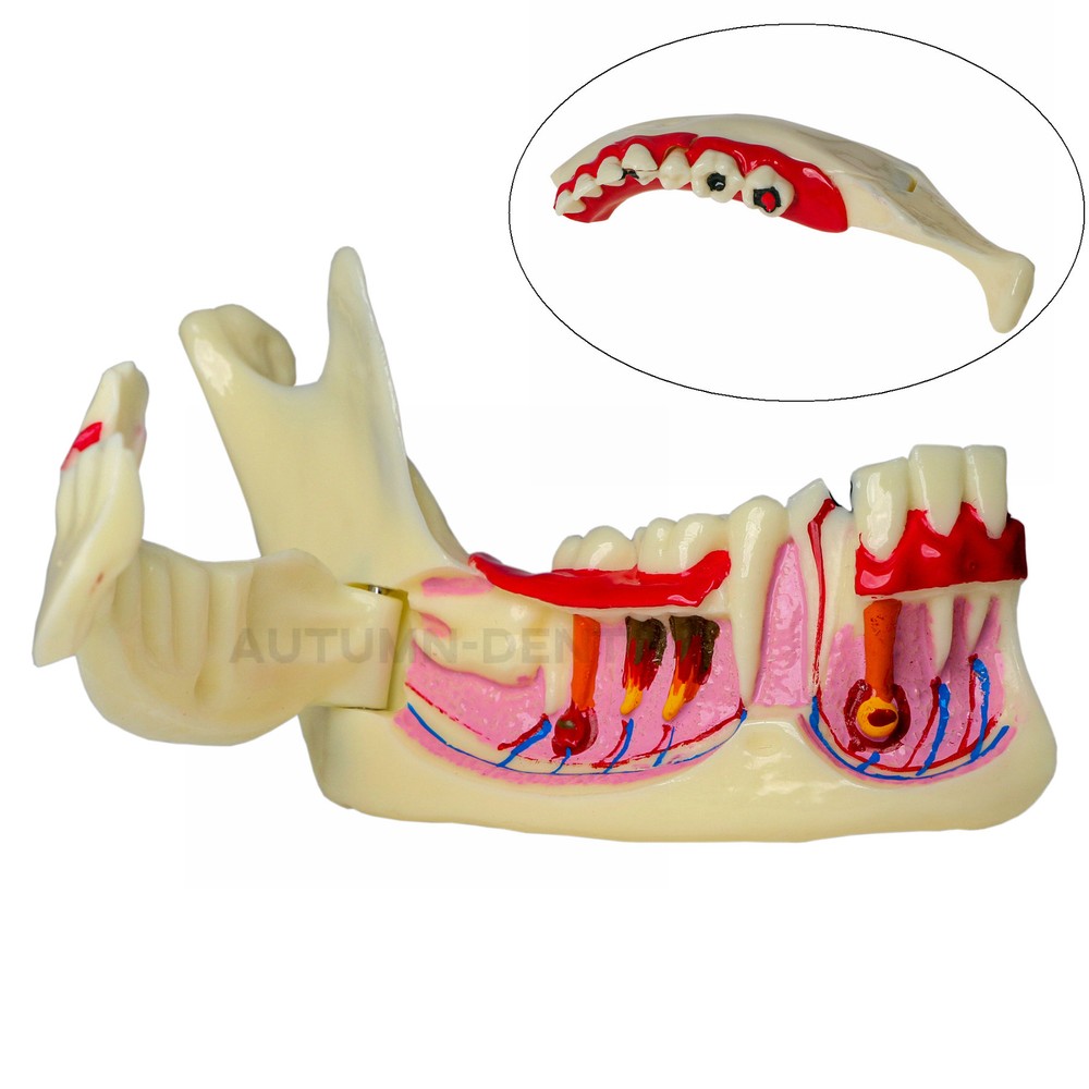 Dental Mandibular Tissue Teeth Anatomical Model Patient Teach Study Education