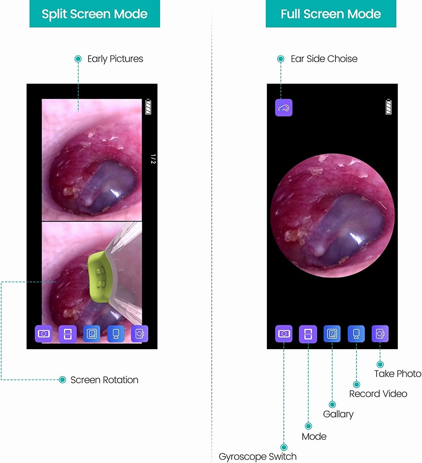 Wireless Otoscope Ear Camera with Dual View, 3.9Mm 720PHD Wifi Ear Scope 6 LED