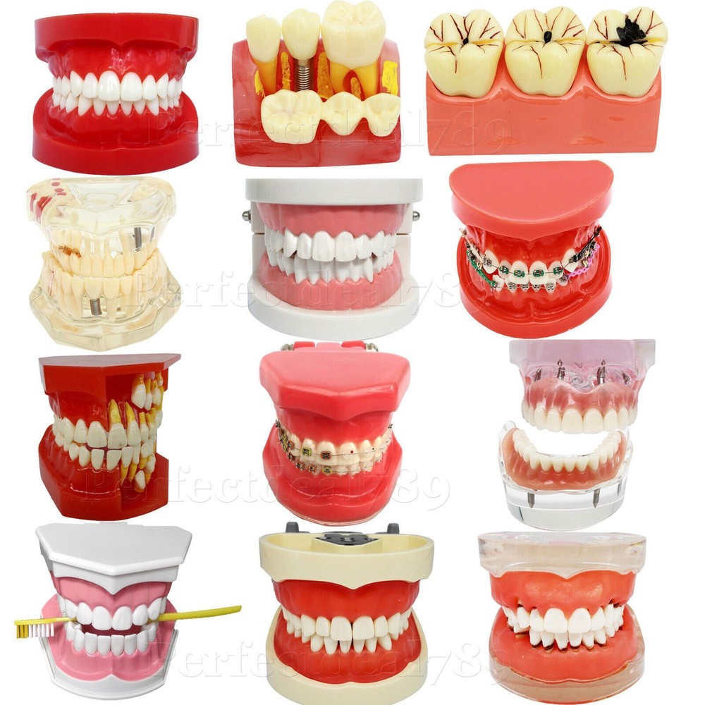 Dental Implant Study Model Analysis Demonstration Tooth Teaching Orthodontics