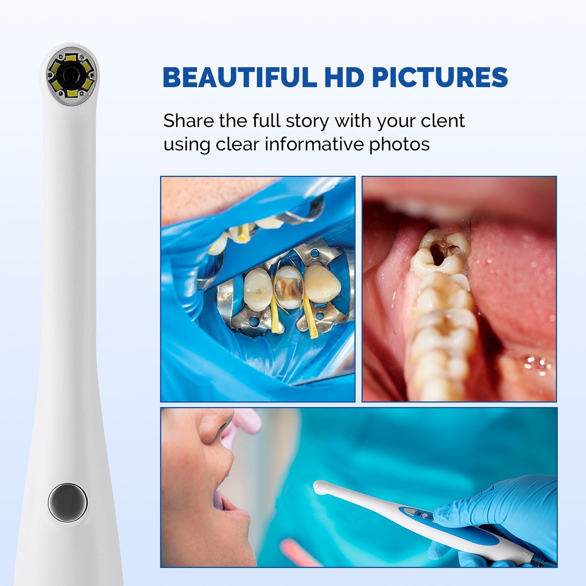 720P HD Dental Intraoral Camera Dental Camera,Button Work Dexis,Apteryx
