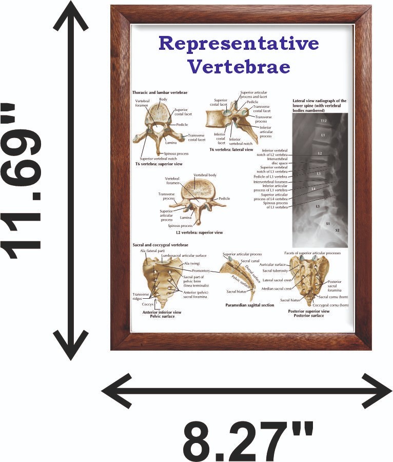 Representative Vertebrae Chart 12x18 inches