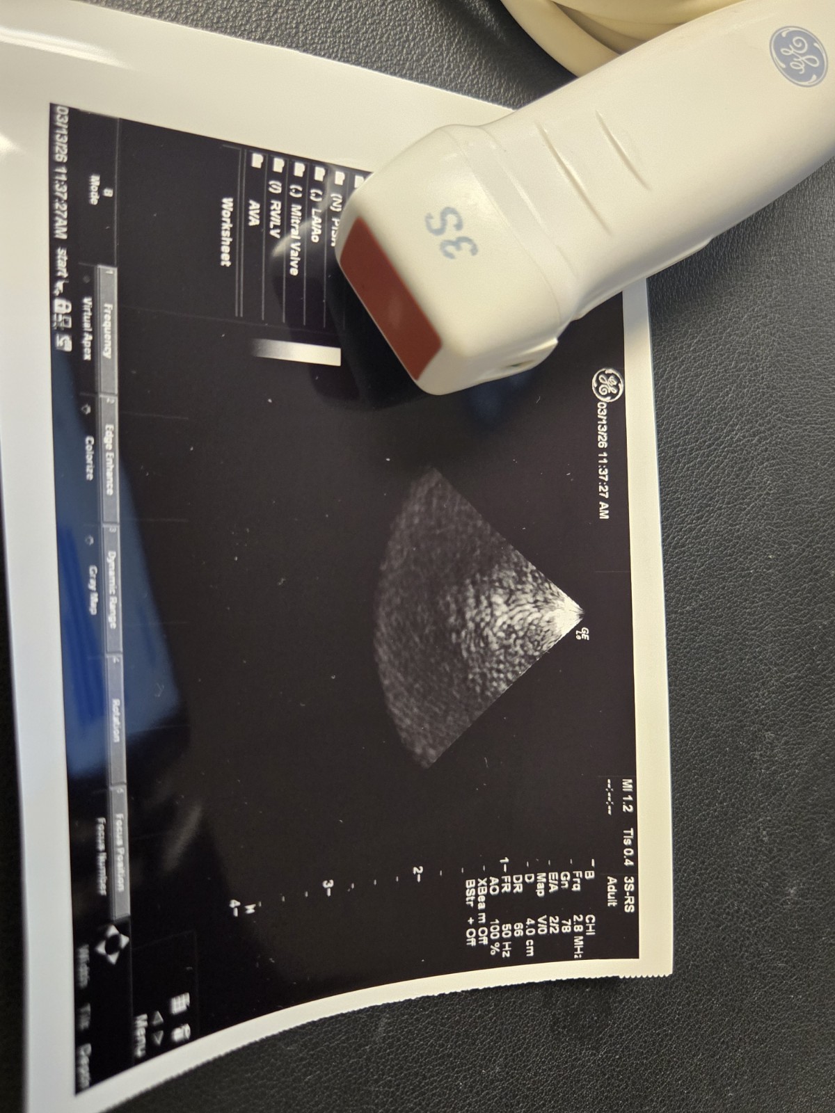 GE 3S-RS Probe for Logiq E Portable Ultrasound