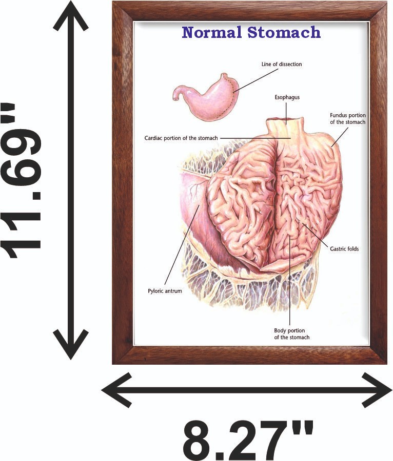 Normal Stomach Chart 12x18 inches