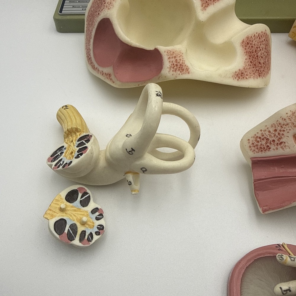 Somso DS5 Ear Anatomical Model - Hearing Inner Ear