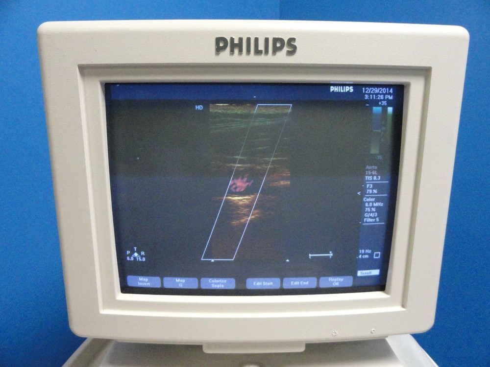Philips HP 15‑6L Compact Linear Array Transducer – For HP 5500 & EnVisor ~ 8452