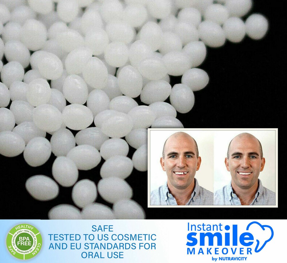 Instant Smile Makeover Select A Tooth Temporary Replacement Kit - All 3 Shades!