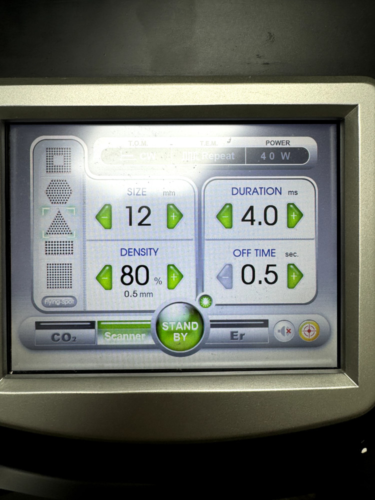 Sandstone Cortex Laser Co2 AND Erbium